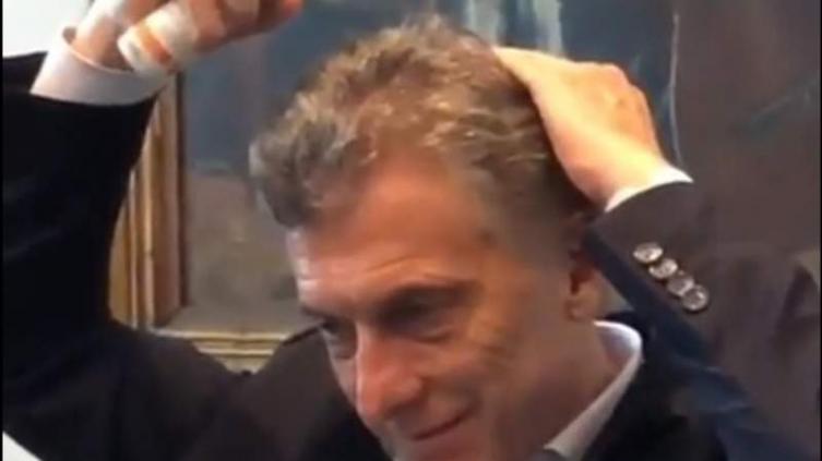 Macri se probó una loción para la calvicie en Instagram