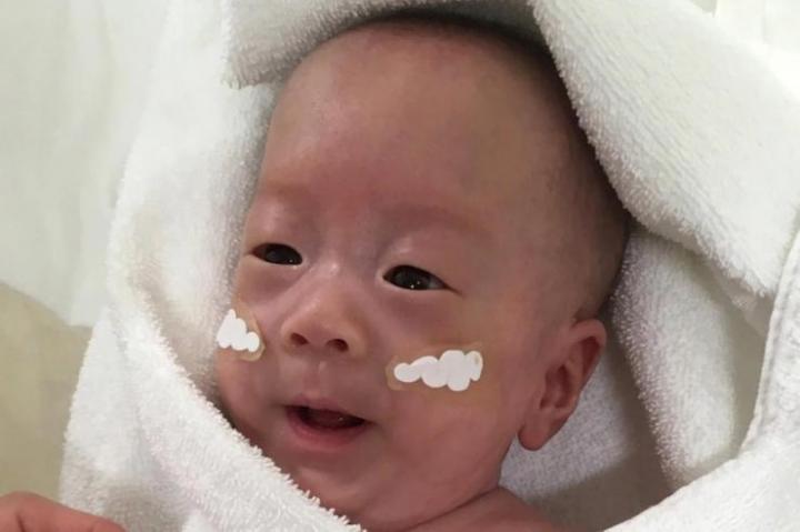 Lograron salvar al bebé más pequeño del mundo
