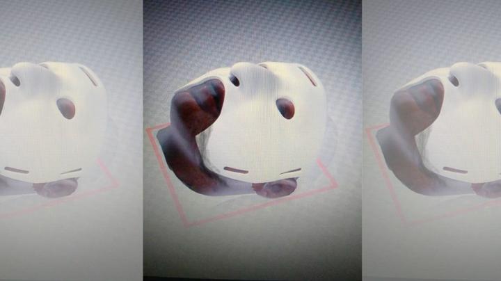 Cirujanos argentinos crean una máscara 3D para reconstrucción facial