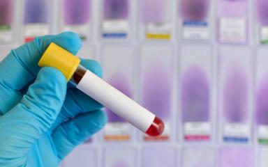 Confirman 3 casos no importados de coronavirus en Argentina