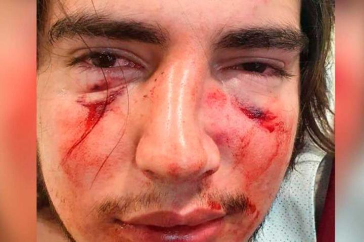 Rugbiers golpearon salvajemente a un joven 