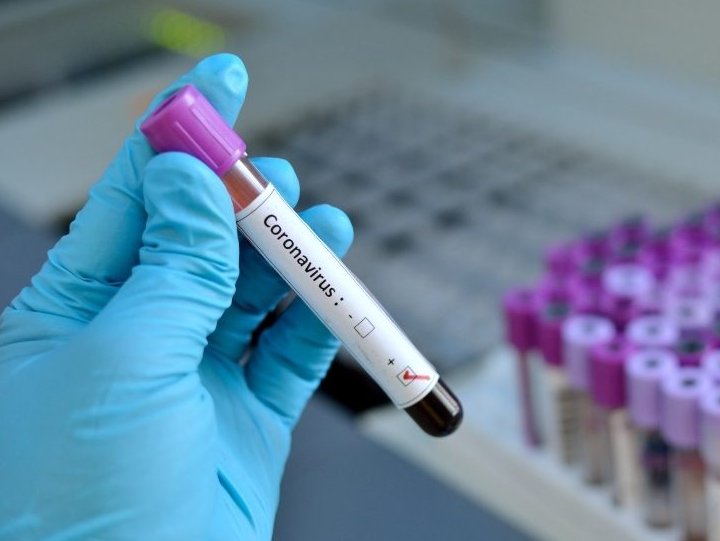 Coronavirus: la ANMAT aprobó el test argentino