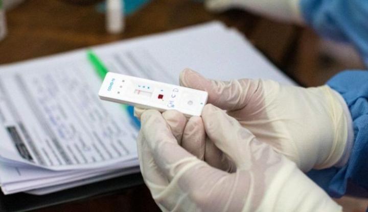 ANMAT aprobó la venta del test rápido de Covid