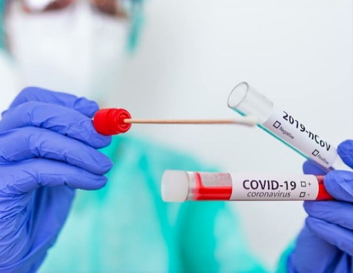 Covid en Santa Fe: 13 muertes y 473 contagios 