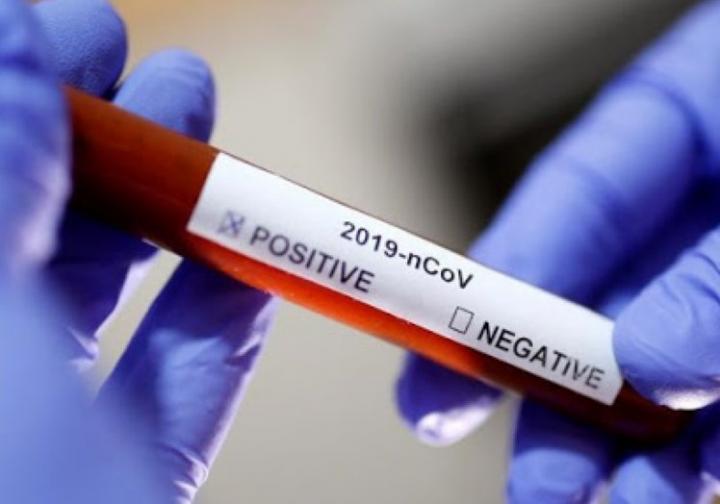 Provincia de Santa Fe, casi sin coronavirus