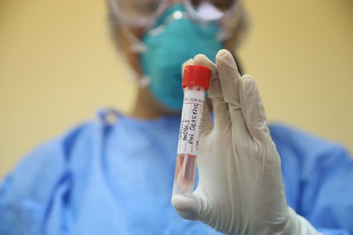 Covid en Santa Fe: 58 contagios y ningún fallecido