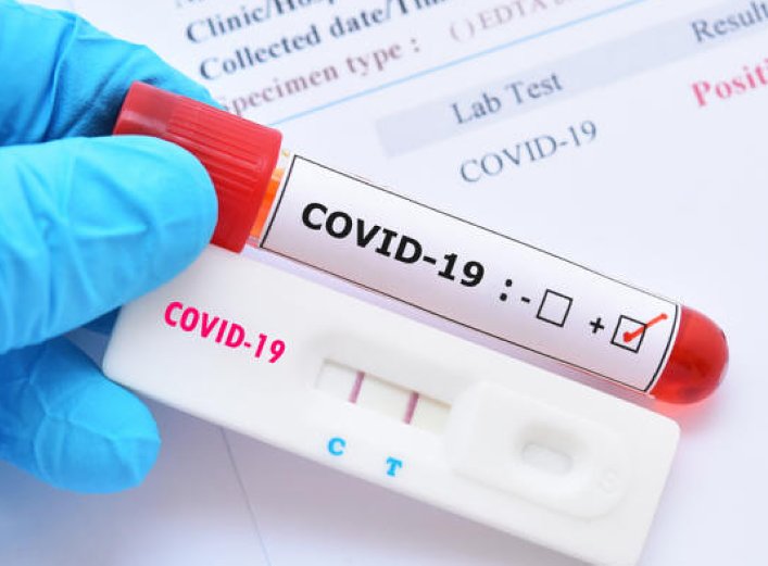 Covid en Santa Fe: 69 contagios y ningún fallecido