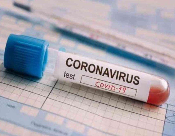 Santa Fe se acercó a los 100 contagios por coronavirus