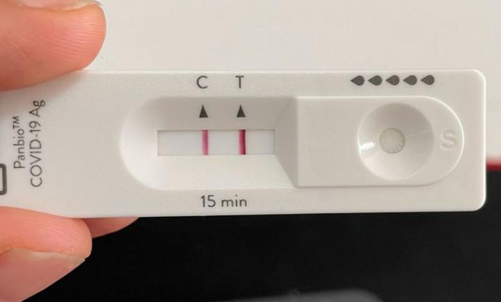 Autotest de covid: cómo se notifica el resultado