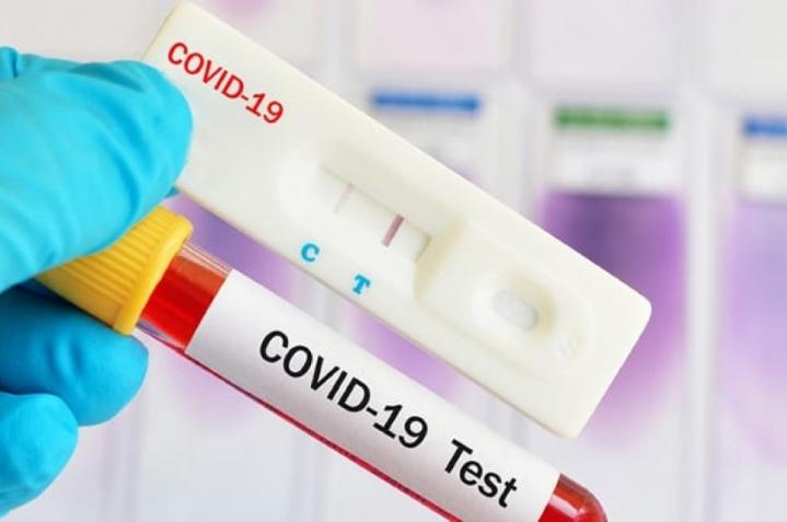 Covid en Argentina: 1 solo muerto por primera vez en dos años