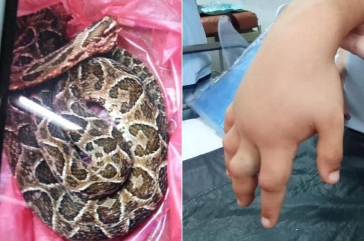 Un nene de 7 años fue mordido por una yarará 