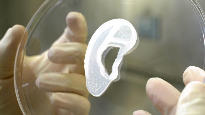 Implantan por primera vez una oreja impresa en 3D 