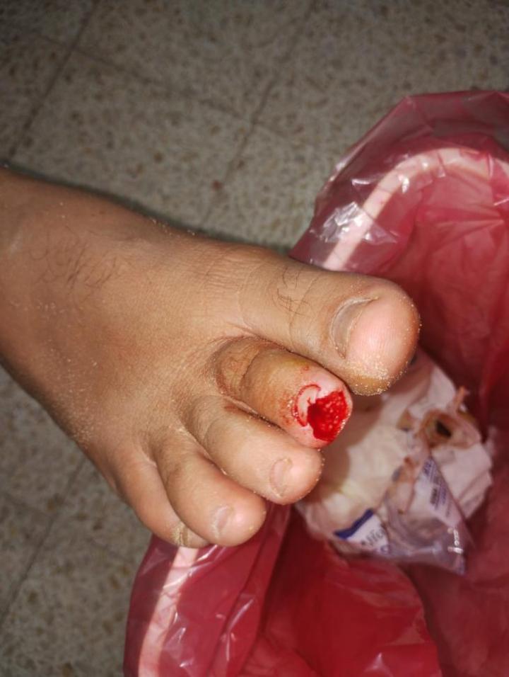 Las palometas atacan de nuevo en la Laguna Setúbal