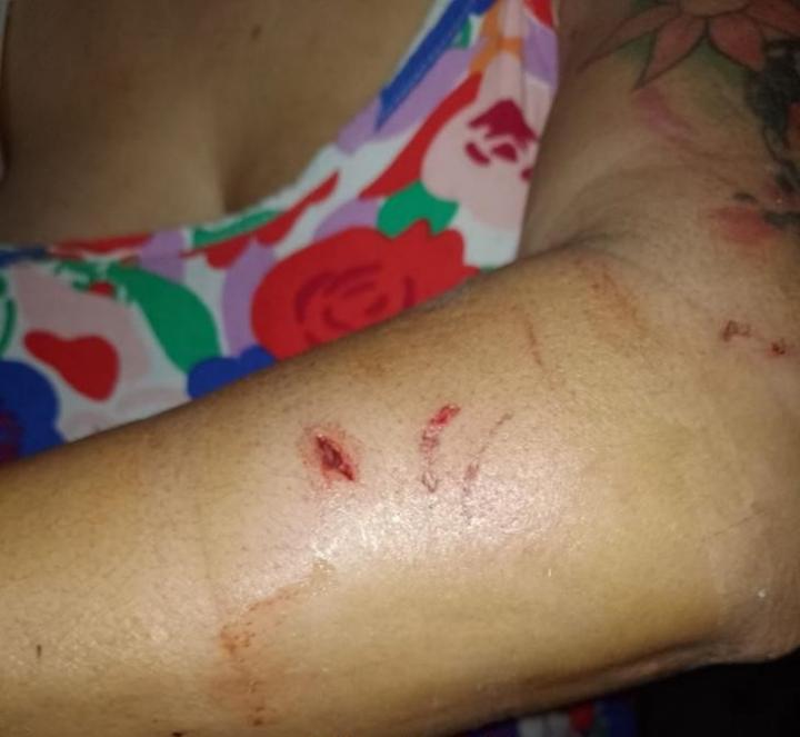 Otro grave ataque de pitbulls en la ciudad de Santa Fe