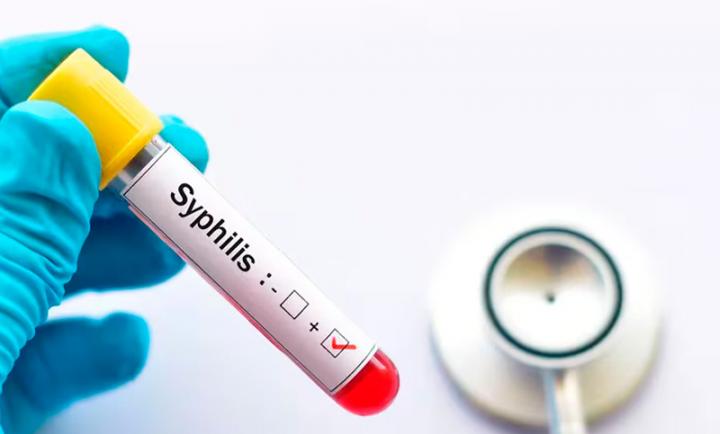 Alerta por récord de contagios de sífilis en el país