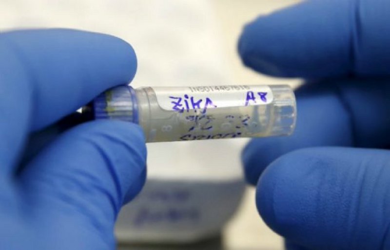 Primer bebé con microcefalia por zika nacido en Córdoba