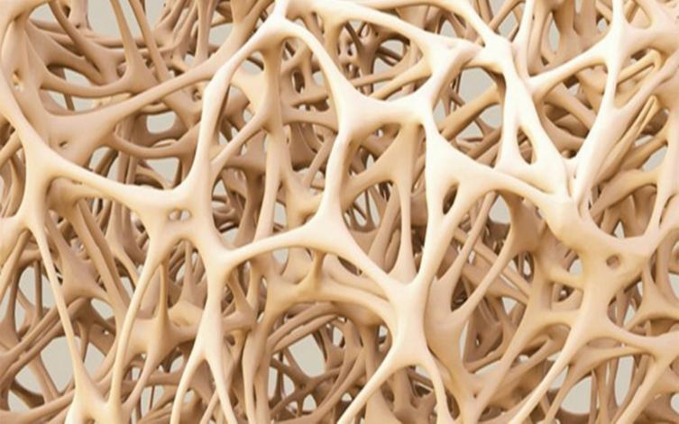 Científicos desarrollaron un biomaterial para reparar huesos