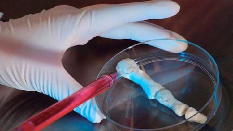 Rosarinos crearon un gel que regenera los huesos